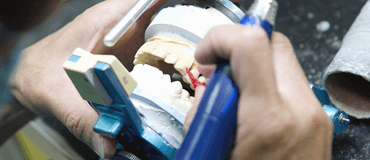 修復・補綴治療